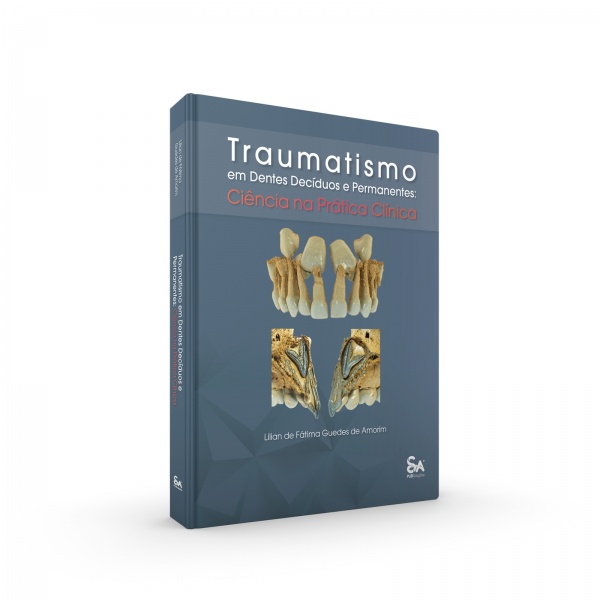 Traumatismo Em Dentes Decíduos E Permanentes - Ciência Na Prática Clínica