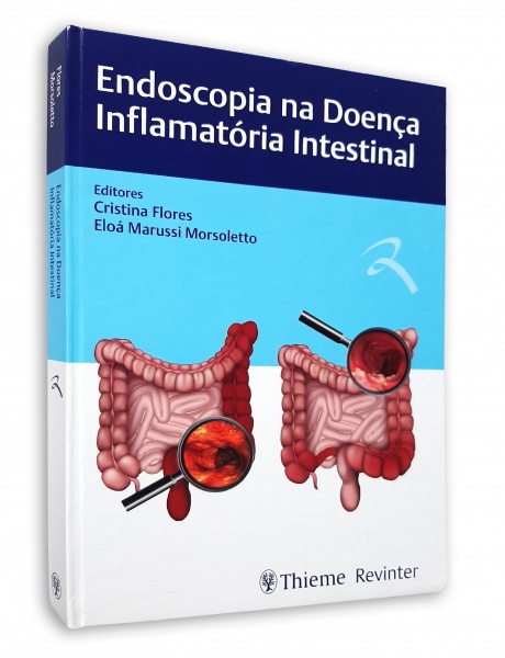 Endoscopia Na Doença Inflamatória Intestinal