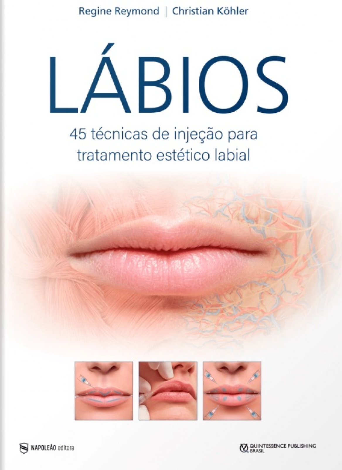 Lábios - 45 Técnicas De Injeção Para Tratamento Estético Labial