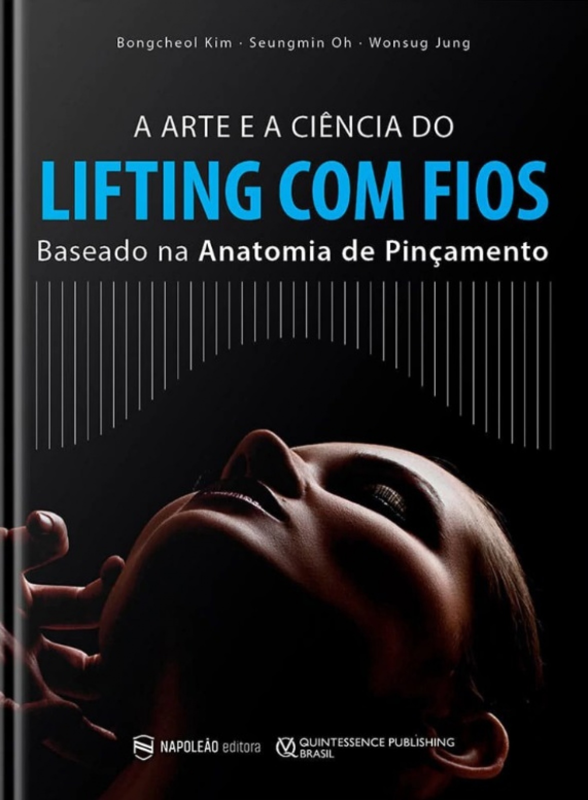 A Arte E A Ciência Do Lifting Com Fios – Baseado Na Anatomia De Pinçamento