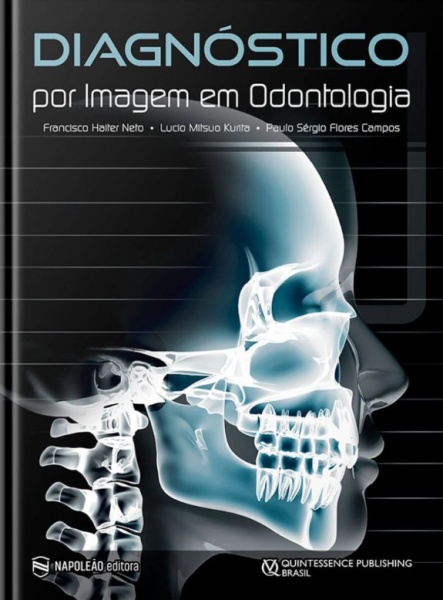 Diagnóstico Por Imagem Em Odontologia
