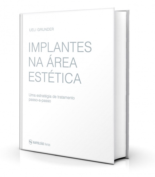 Implantes Na Área Estética – Uma Estratégia De Tratamento Passo-A-Passo