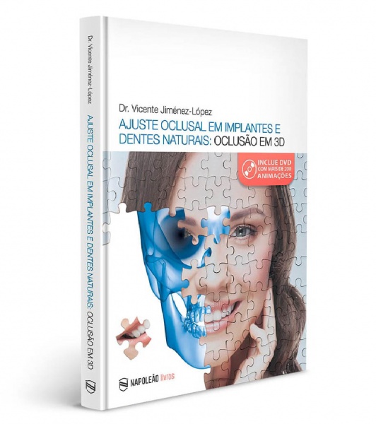 Ajuste Oclusal Em Implantes E Dentes Naturais: Oclusão Em 3D – Vicente Jiménez-Lépez