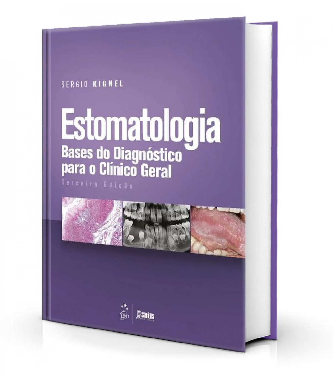 Estomatologia - Bases Do Diagnóstico Para O Clínico Geral
