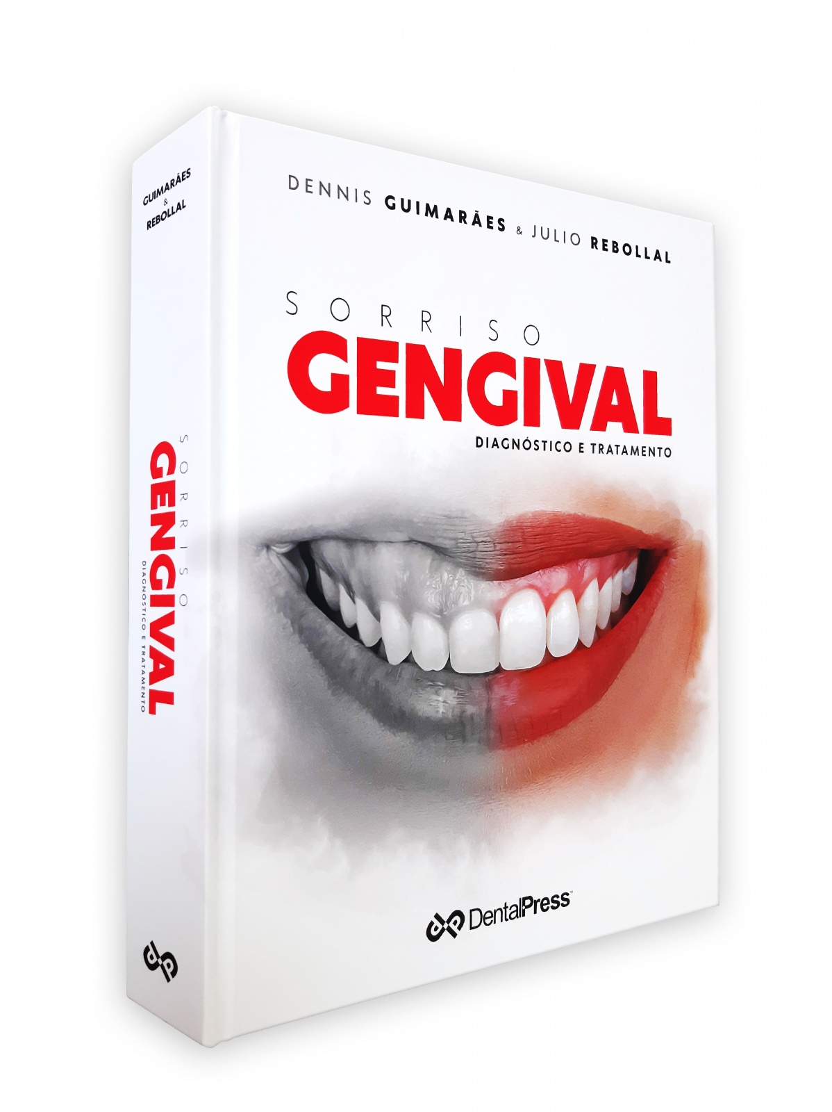 Sorriso Gengival - Diagnóstico E Tratamento