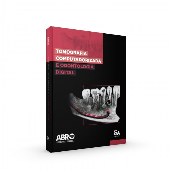 Tomografia Computadorizada E Odontologia Digital