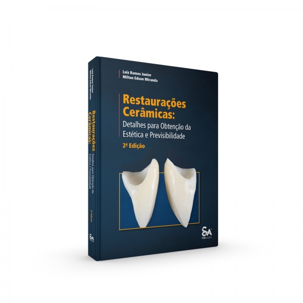 Restaurações Cerâmicas: Detalhes Para Obtenção Da Estética E Previsibilidade