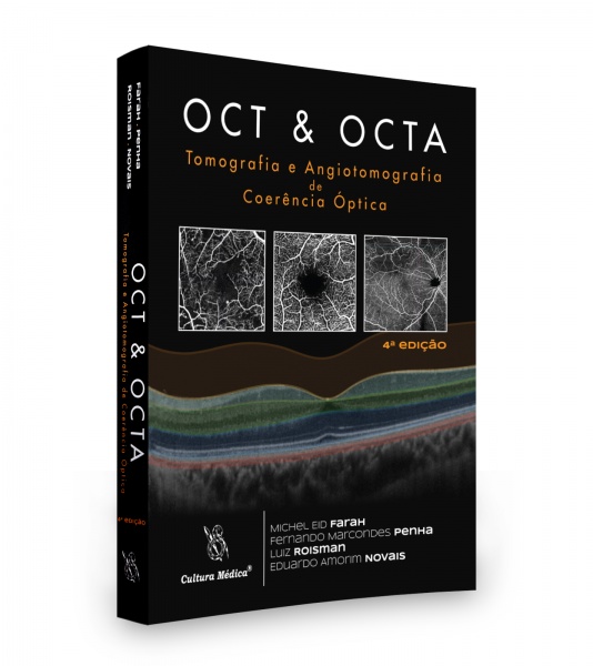 Oct & Octa Tomografia E Angiotomografia De Coerência Óptica