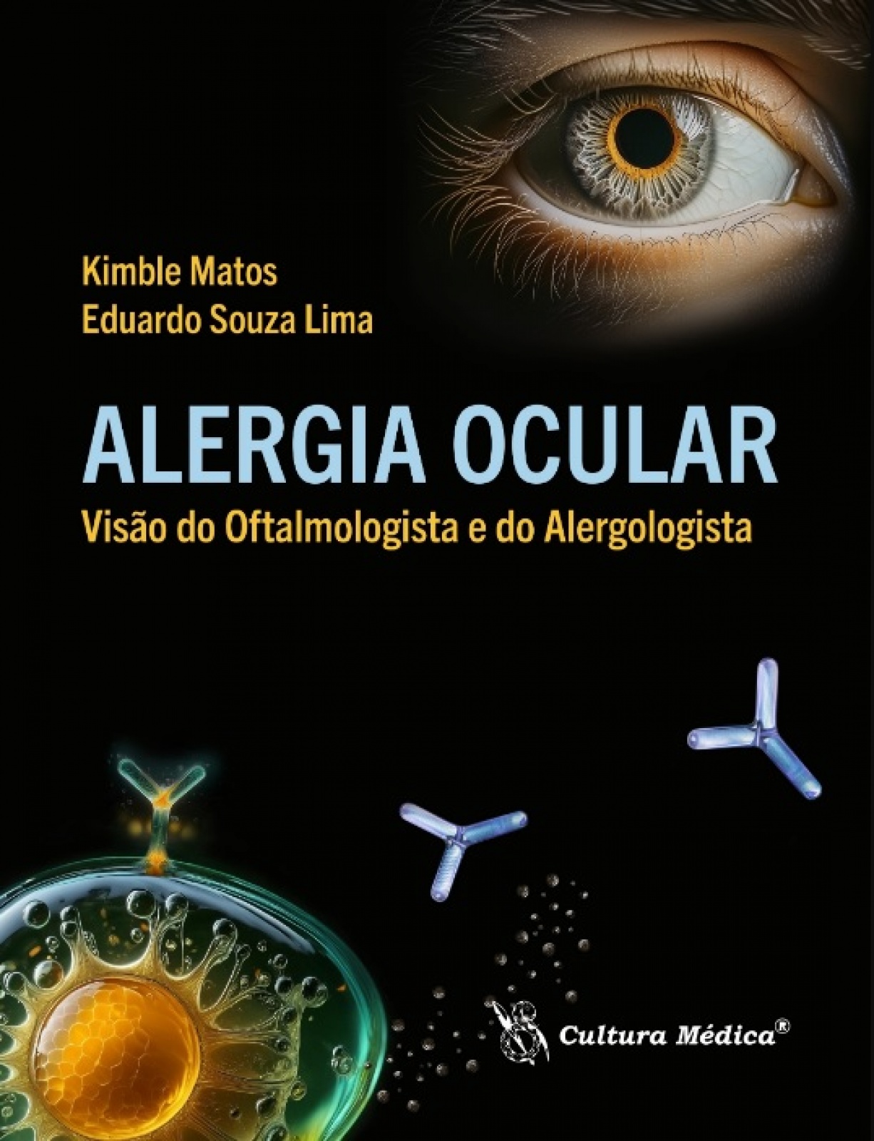 Alergia Ocular – Visão Do Oftalmologista E Do Alergologista