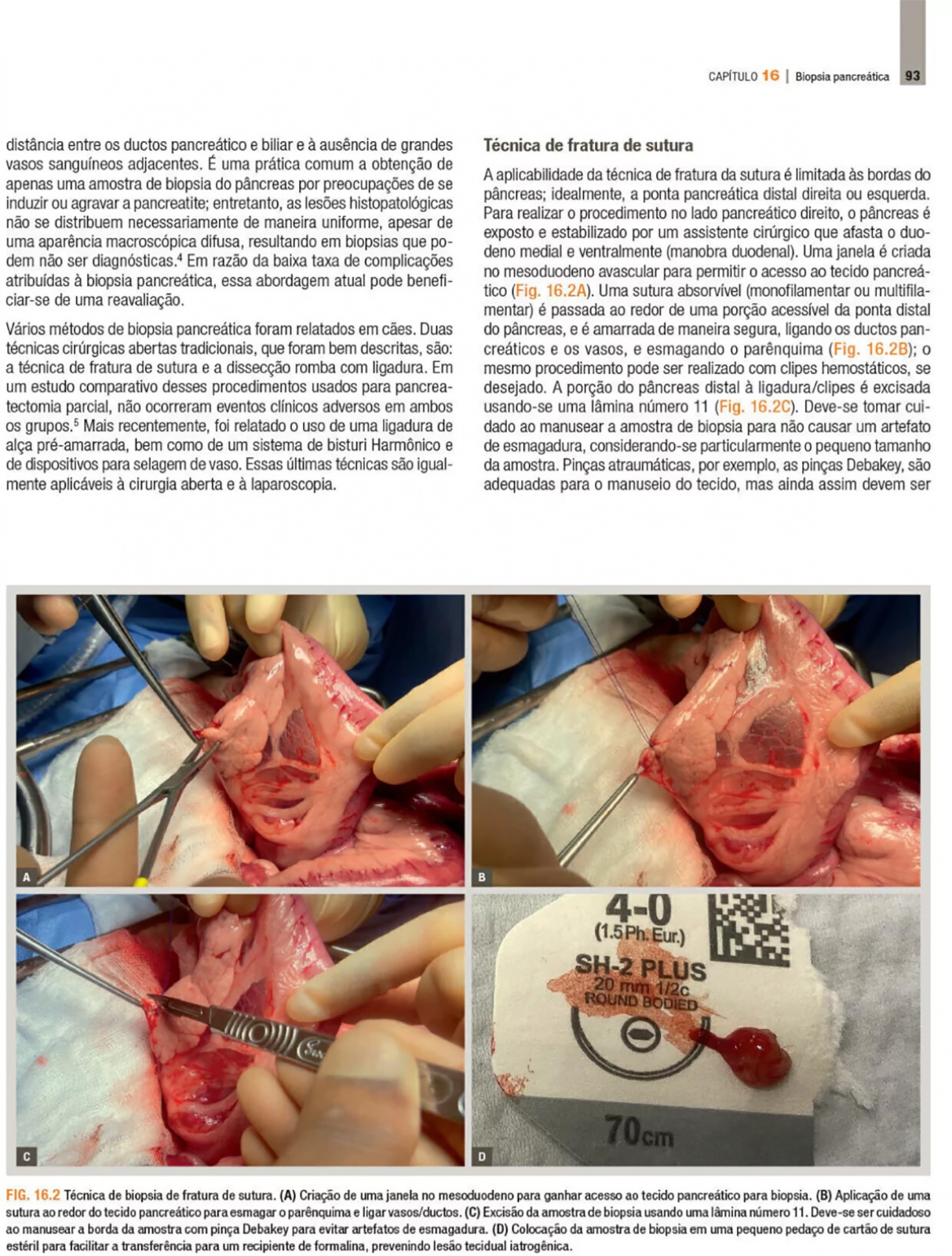 Doenças Do Sistema Hepatobiliar E Do Pâncreas Exócrino Do Cão