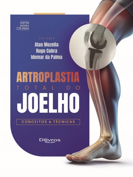 Artroplastia Total Do Joelho: Conceitos E Técnicas