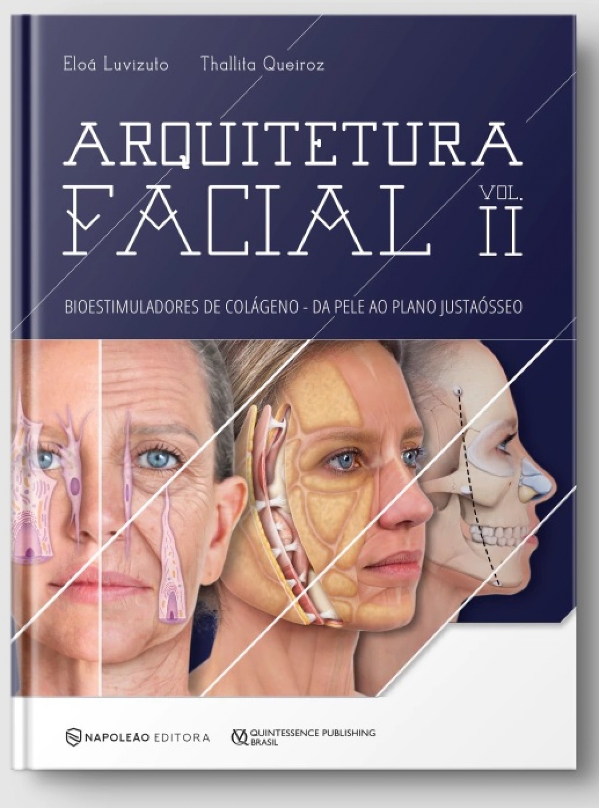 Luvizuto, Queiroz | Arquitetura Facial Vol. Ii - Bioestimuladores De Colágeno – Da Pele Ao Plano Justa-Ósseo