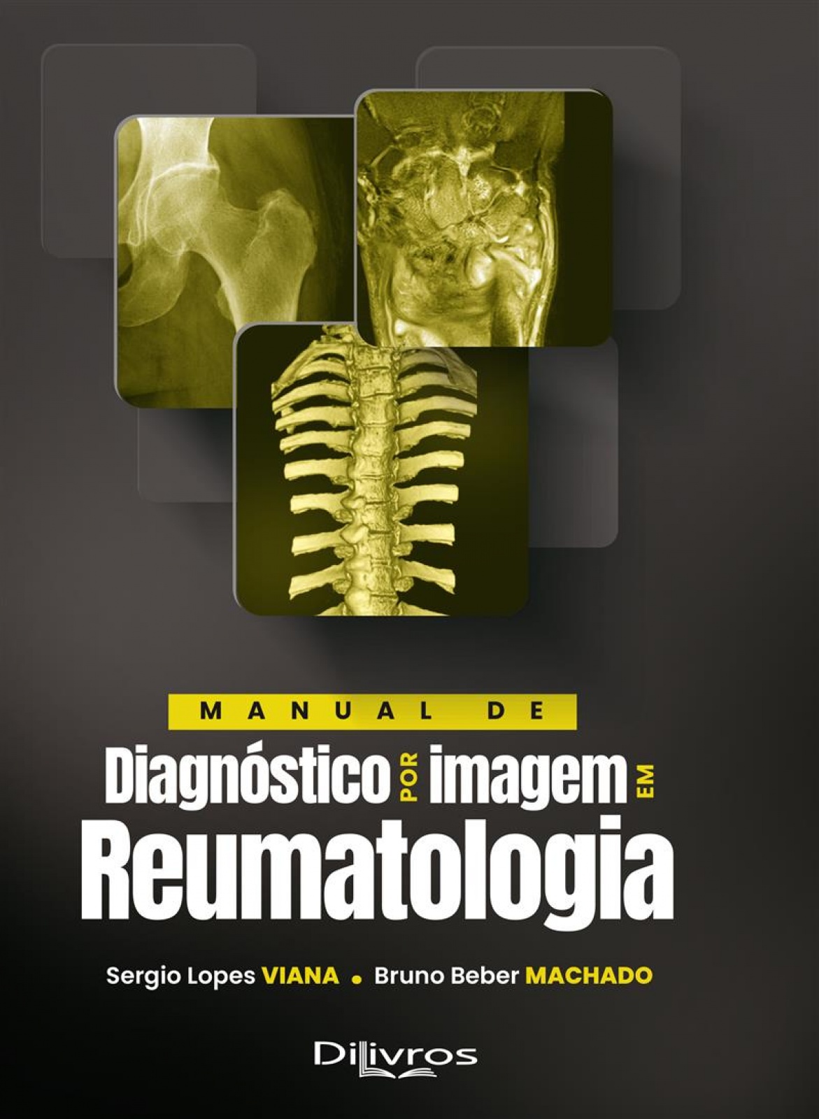 Manual De Diagnóstico Por Imagem Em Reumatologia