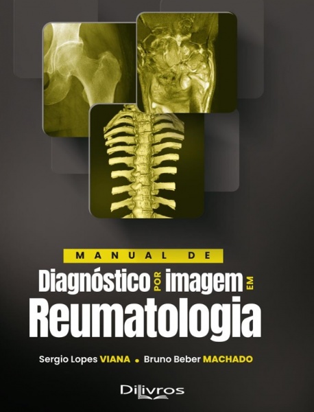 Manual De Diagnóstico Por Imagem Em Reumatologia