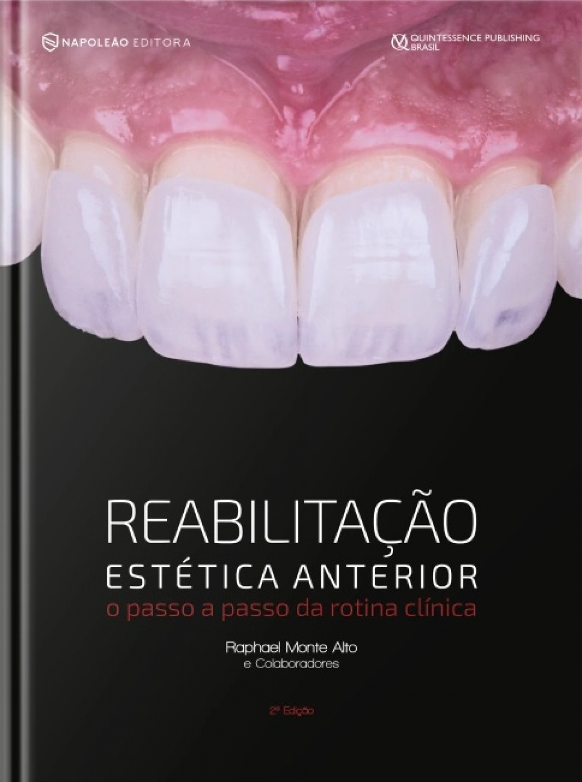 Reabilitação Estética Anterior - O Passo A Passo Da Rotina Clínica 2º Edição