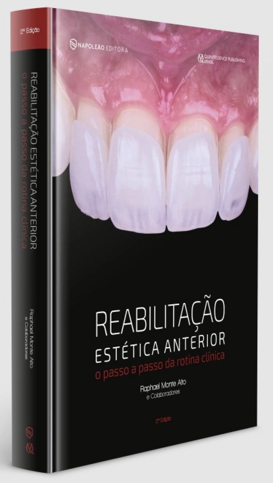 Reabilitação Estética Anterior - O Passo A Passo Da Rotina Clínica 2º Edição