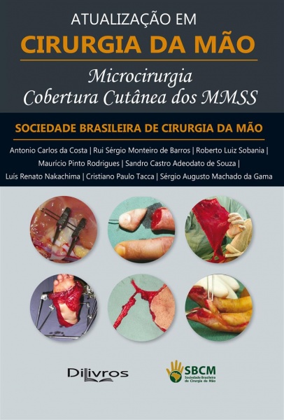 Microcirurgia Cobertura Cutânea Dos Mmss: Atualização Em Cirurgia Da Mão