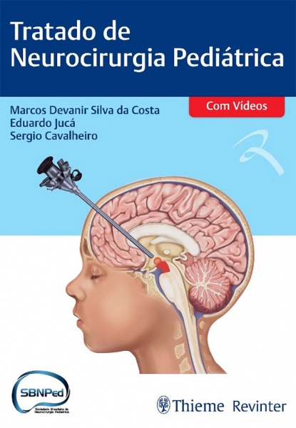 Tratado De Neurocirurgia Pediátrica
