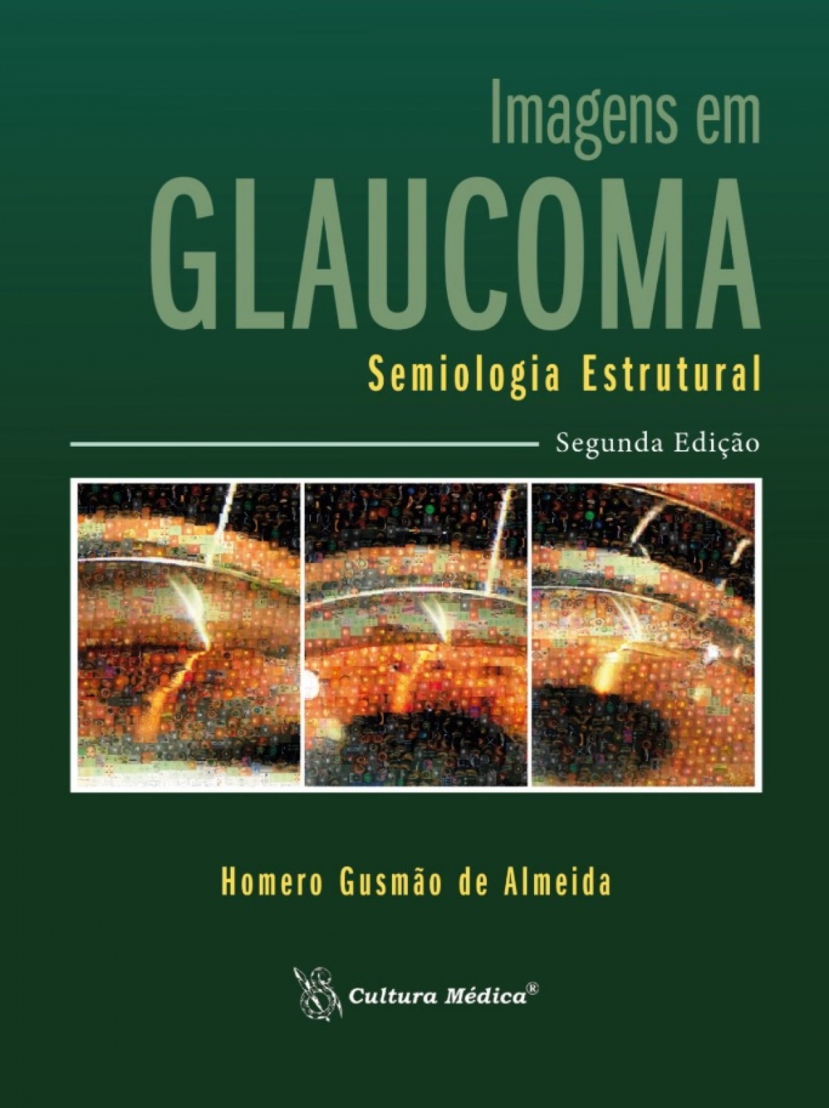 Imagens Em Glaucoma – Semiologia Estrutural