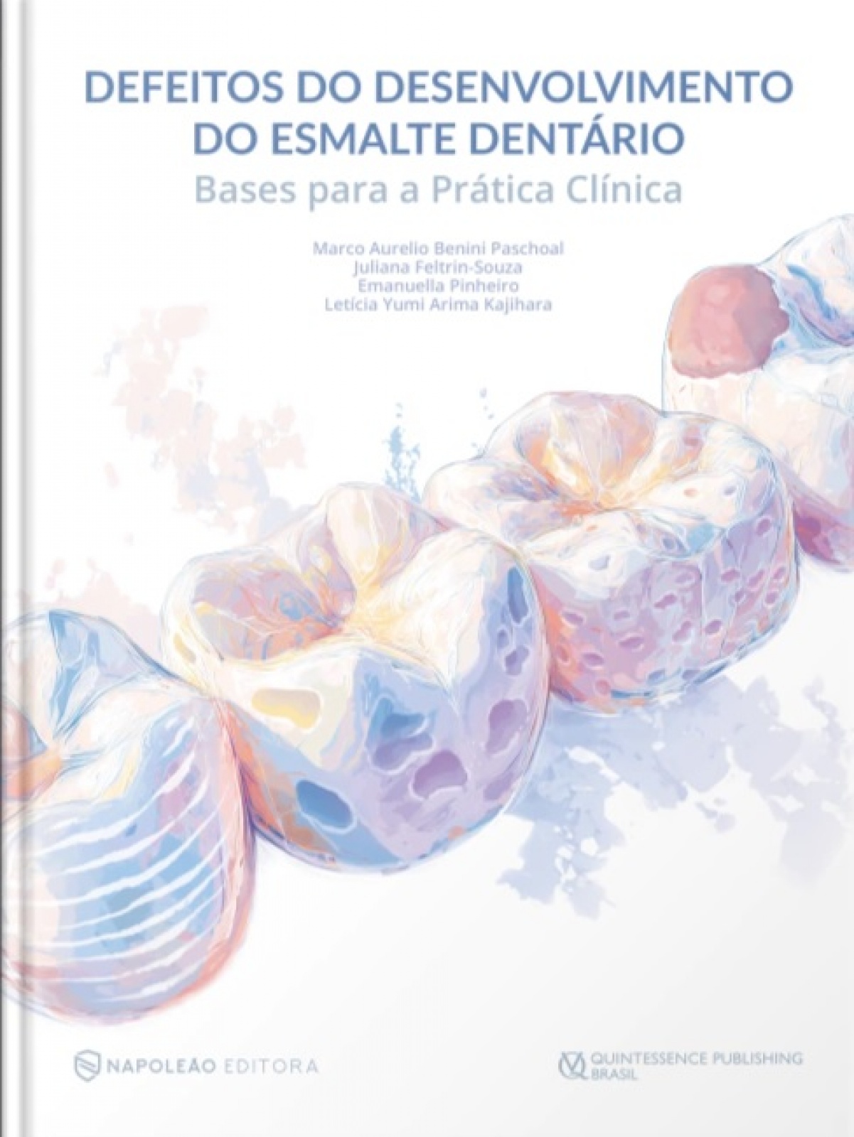 Defeitos Do Desenvolvimento Do Esmalte Dentário