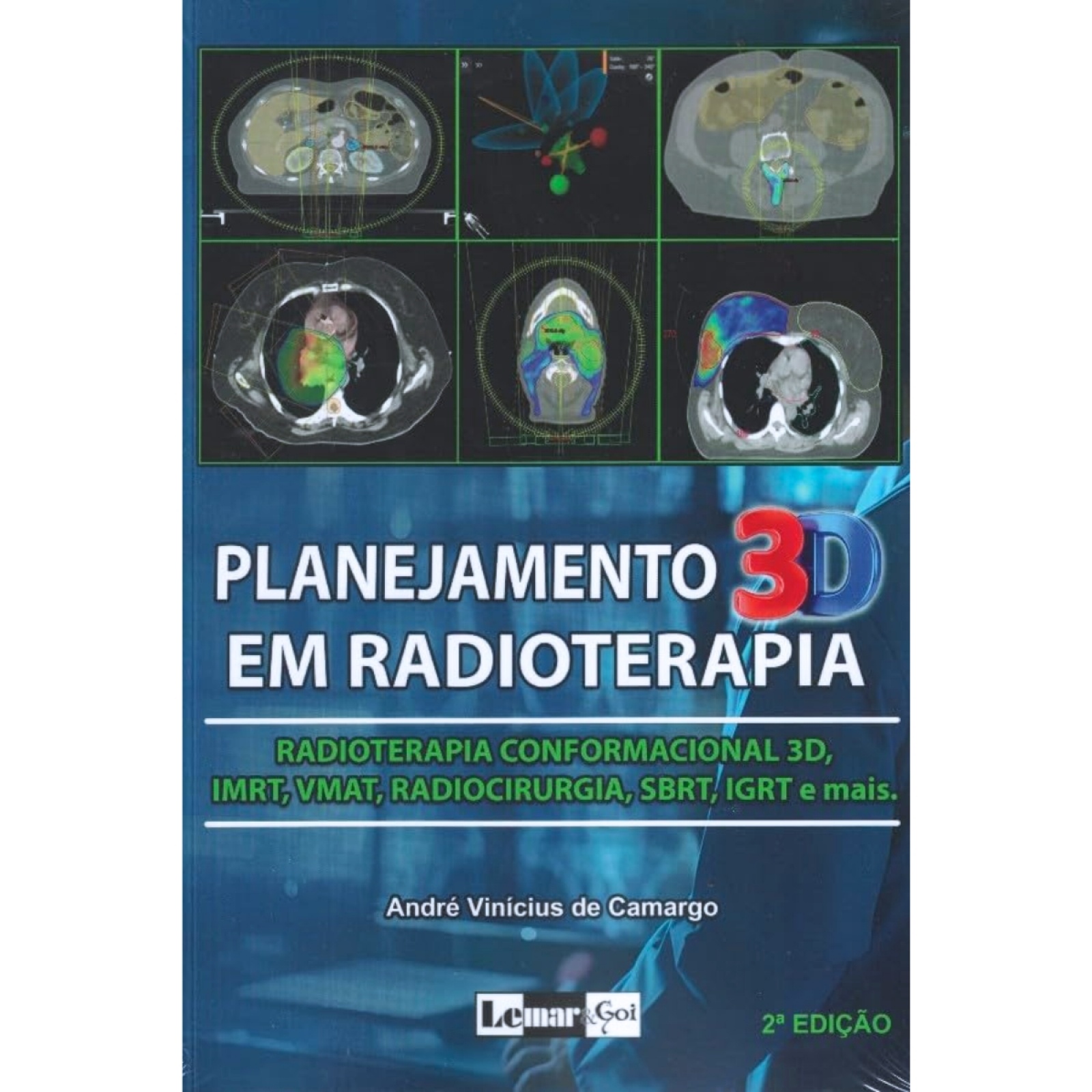 Planejamento 3D Em Radioterapia - Radioterapia Conformacional 3D, Imrt, Vmat, Radiocirurgia, Sbrt, Igrt E Mais