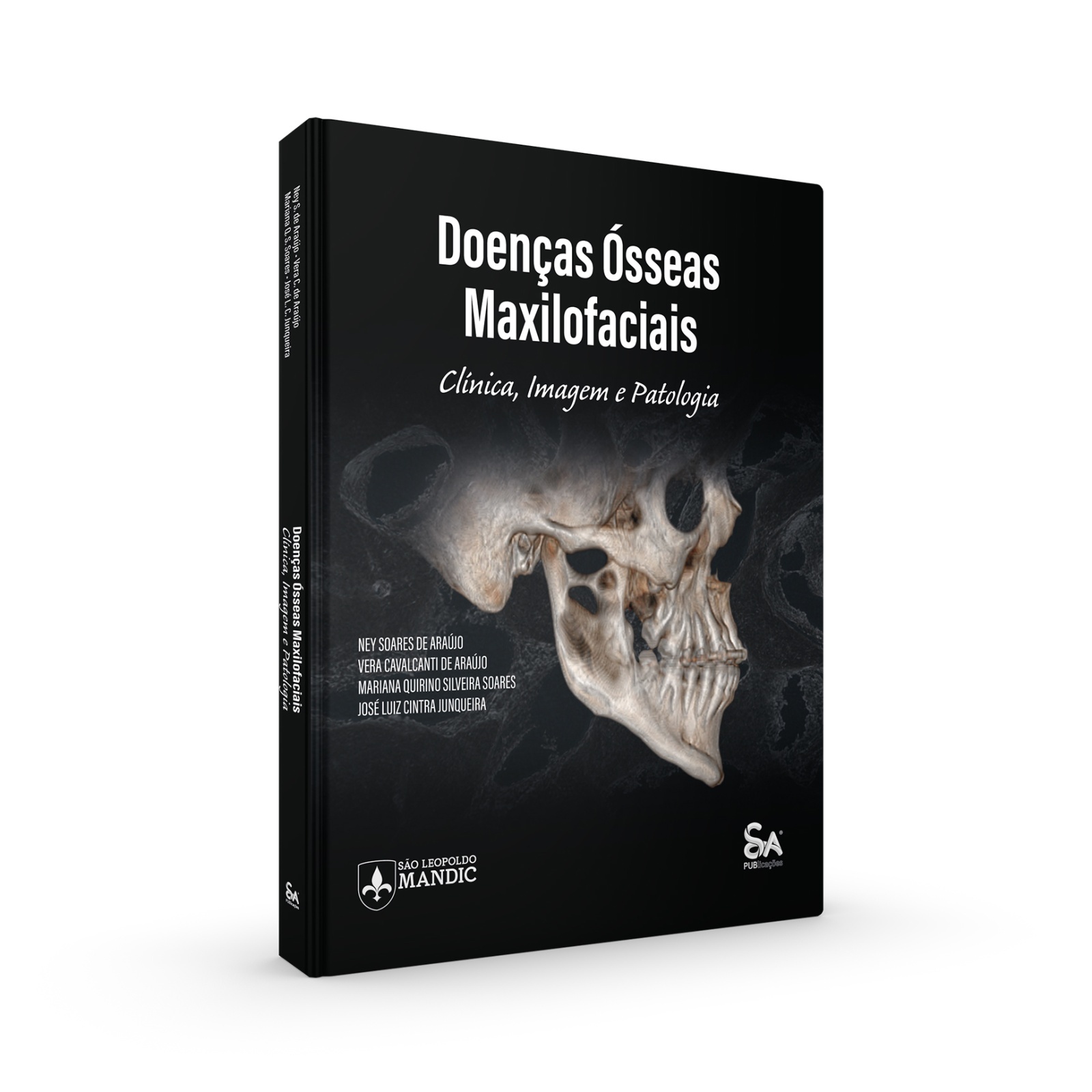 Doenças Ósseas Maxilofaciais Clínica Imagem E Patologia