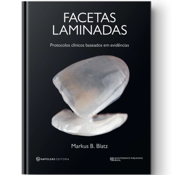 Facetas Laminadas – Protocolos Clínicos Baseados Em Evidências