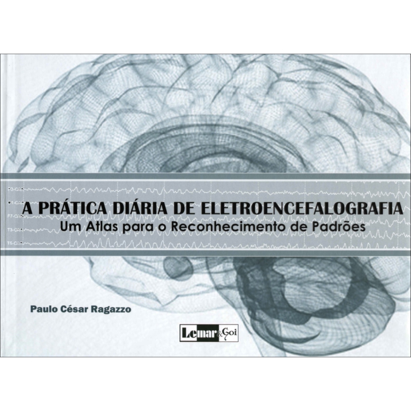 A Prática Diária De Eletroencefalografia - Um Atlas Para O Reconhecimento De Padrões