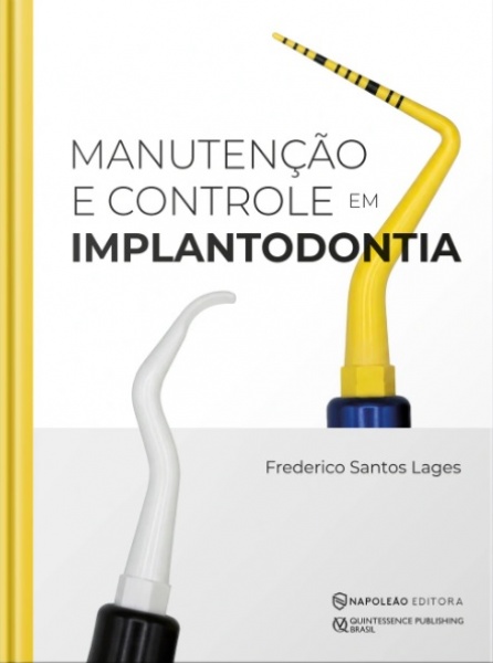 Manutenção E Controle Em Implantodontia