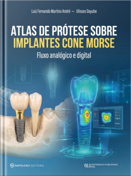 Atlas De Prótese Sobre Implantes Cone Morse - Fluxo Analógico E Digital